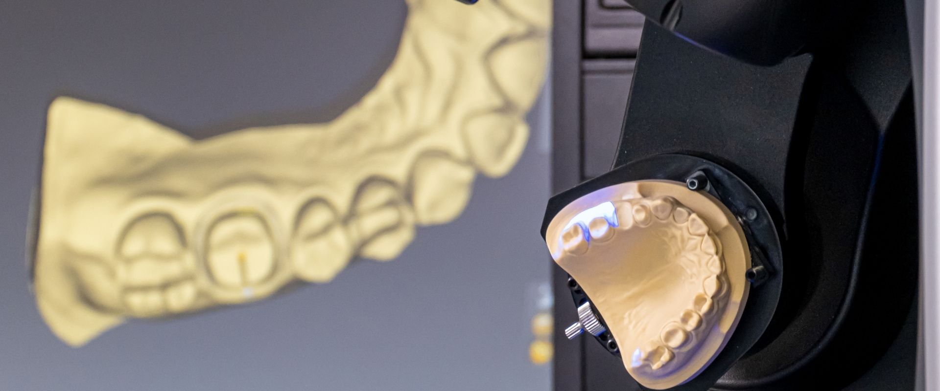 Blue Green Smile - Dijital Diş Hekimliğinde CAD/CAM Sistemleri